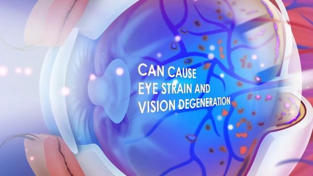 Get Relief from Digital Eye Strain with BRAND'S® Lutein Essence Today! смотреть онлайн