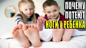 Почему потеют ноги у ребёнка