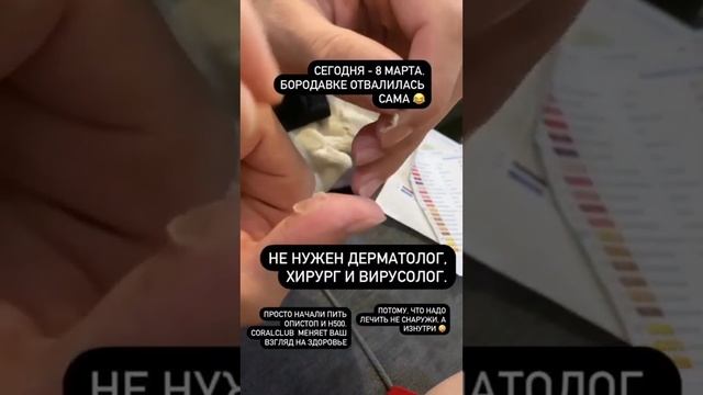 Результат. Бородавка.
