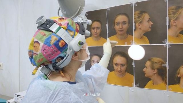 Пьезо ринопластика. История пациента. Пластический хирург Юлия Лебедева.