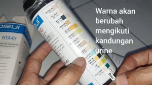 Review Reagent Strip Urine 13 Test | Mikroalbumin Kreatinin Asam askorbat
