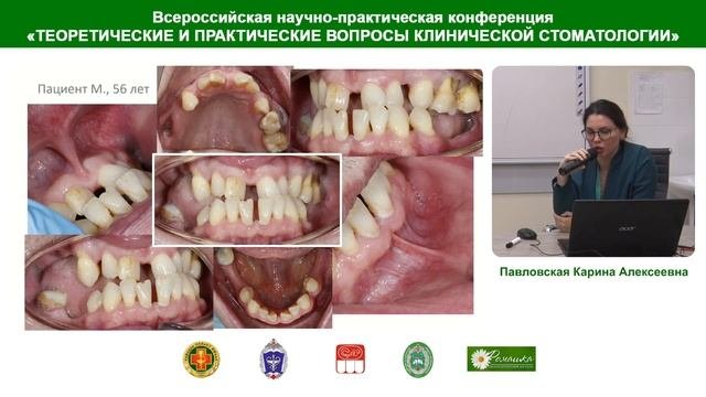 Павловская К.А. Междисциплинарный подход в подготовке к ортодонтическому лечению взрослых пациентов