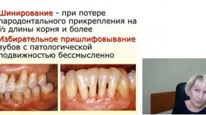 Лечение пародонтита