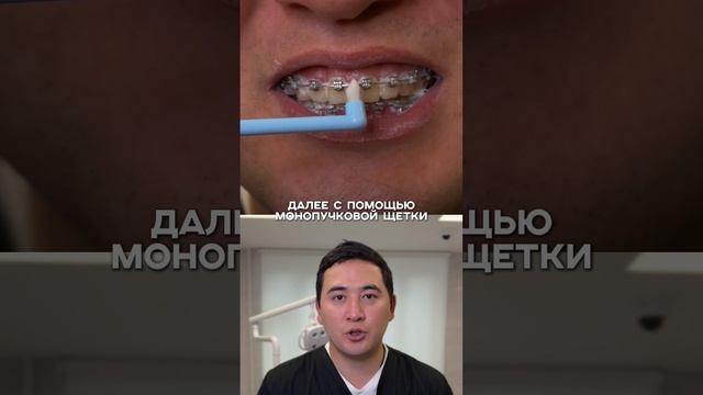 Как правильно чистить зубы с брекетами 👇