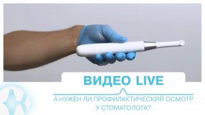 Видео live | А нужен ли профилактический осмотр у стоматолога?