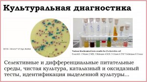 13. Культуральные методы диагностики