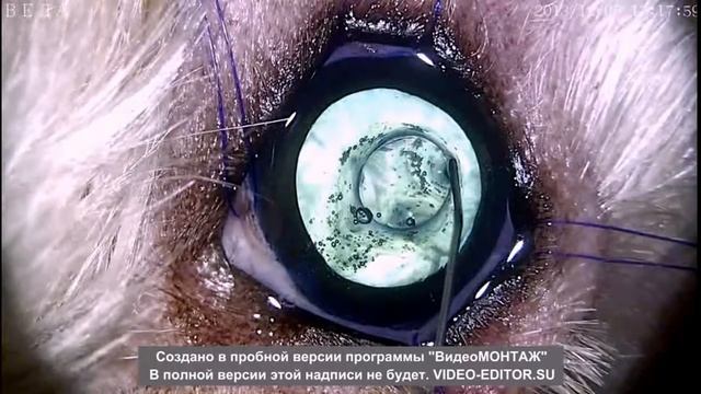 front hardware capsulorhexis. передний аппаратный капсулорексис смотреть онлайн