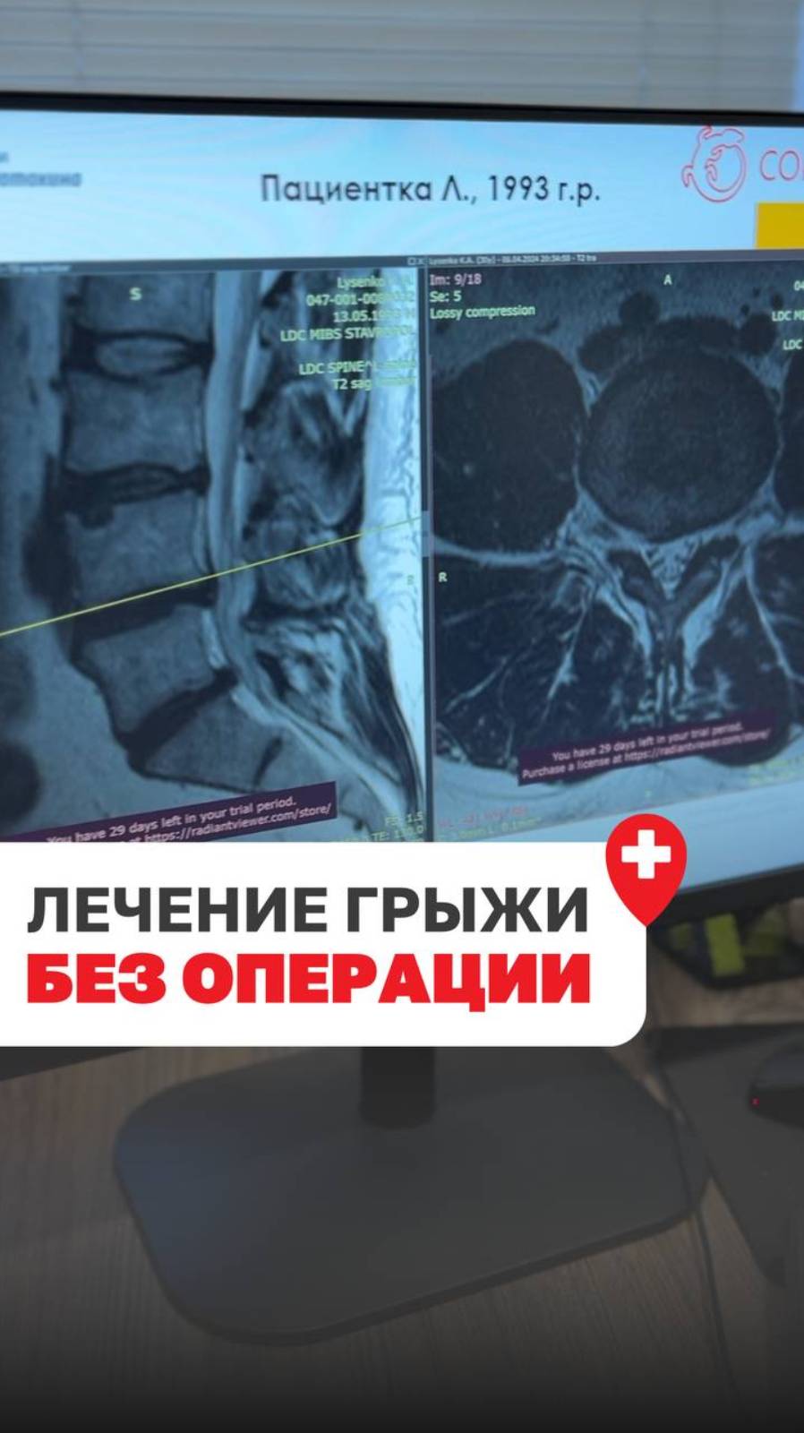 ЛЕЧЕНИЕ ГРЫЖИ БЕЗ ОПЕРАЦИИ