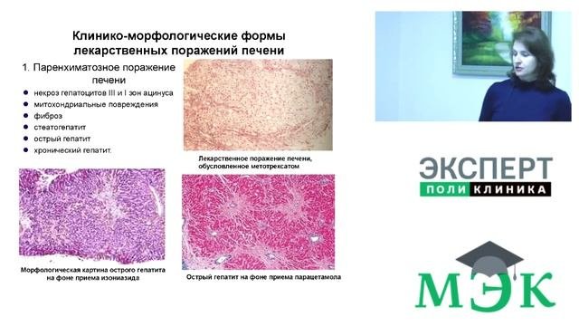 Лекарственные поражения печени лекция для врачей