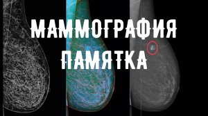 МАММОЛОГИЧЕСКИЙ СКРИНИНГ МУСТАФИН ЧИНГИС 79104653497 КУРС МАММОЛОГИИ