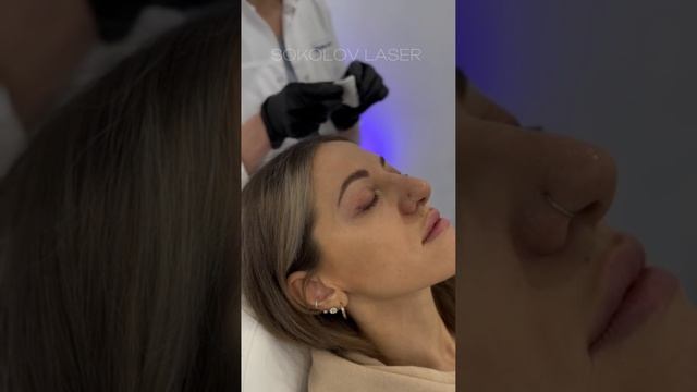 Удаление татуажа стрелочек 🤩