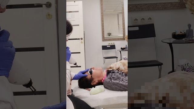 Безопасное удаление татуажа бровей