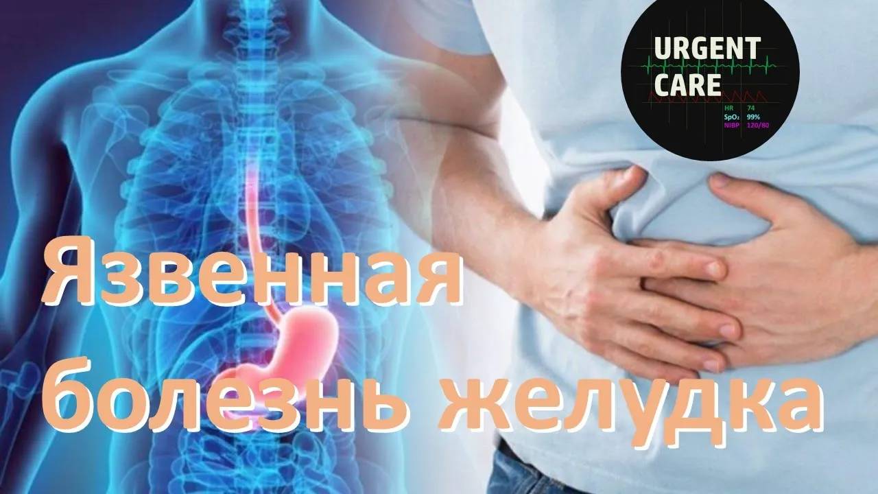 Язвенная болезнь желудка смотреть онлайн