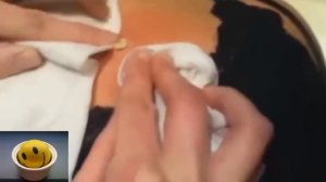 💥😱 Epic Pimple Popping Compilation: Flying Zits & Massive Cyst Explosions! 😱💥