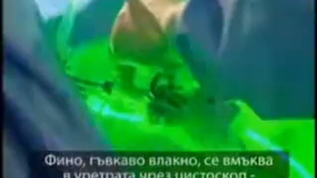 Половин век е нужен на мъжете, за да развият увеличена простата...