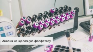 Анализ на щелочную фосфатазу