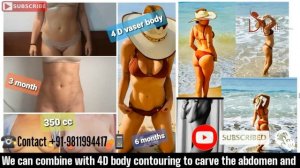 A Must Watch Video for you if you want to know about BBL ( Brazilian Buttock Lift Procedure)