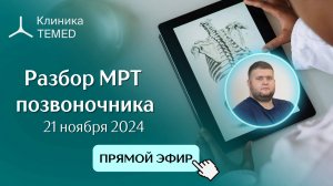 Прямой эфир "Разбор МРТ позвоночника" с Евдокимовым А.С.