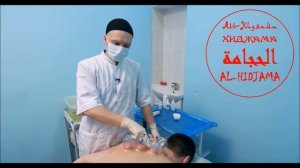 АЛЬ-ХИДЖАМА. ЛЕЧЕНИЕ ПО СУННЕ