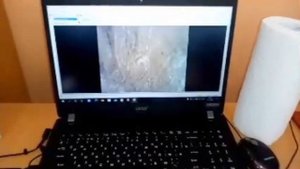 Лабораторная работа «Изучение клеток кожицы чешуи лука под световым и электронным микроскопом на пр