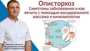 Описторхоз. Симптомы заболевания и как лечить с помощью висцерального массажа и кинезиологии.