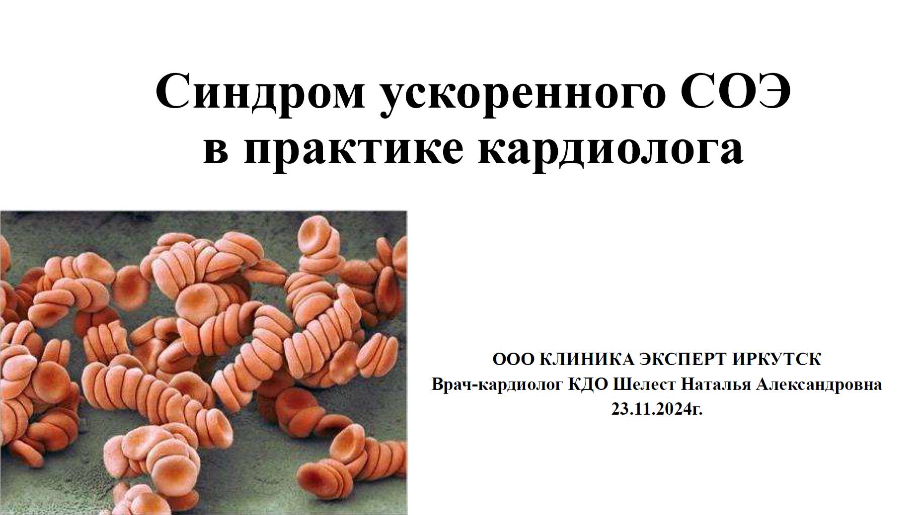 Шелест Н.А. Синдром ускоренного СОЭ в практике кардиолога. 23.11.2024.