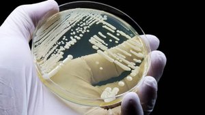 Вспышка устойчивого ко всем препаратам грибка Candida auris распространилась по всему миру