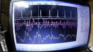 АКСЕЛЕРОМЕТР и ГРАММОФОН для МОТОРТЕСТЕРА и ОСЦИЛЛОГРАФА Фильм 3.