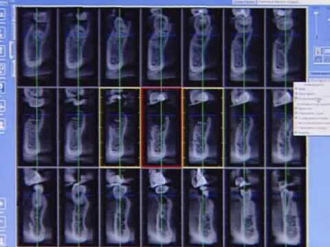 Сердце стоматологической диагностики - Planmeca ProMAX 3D