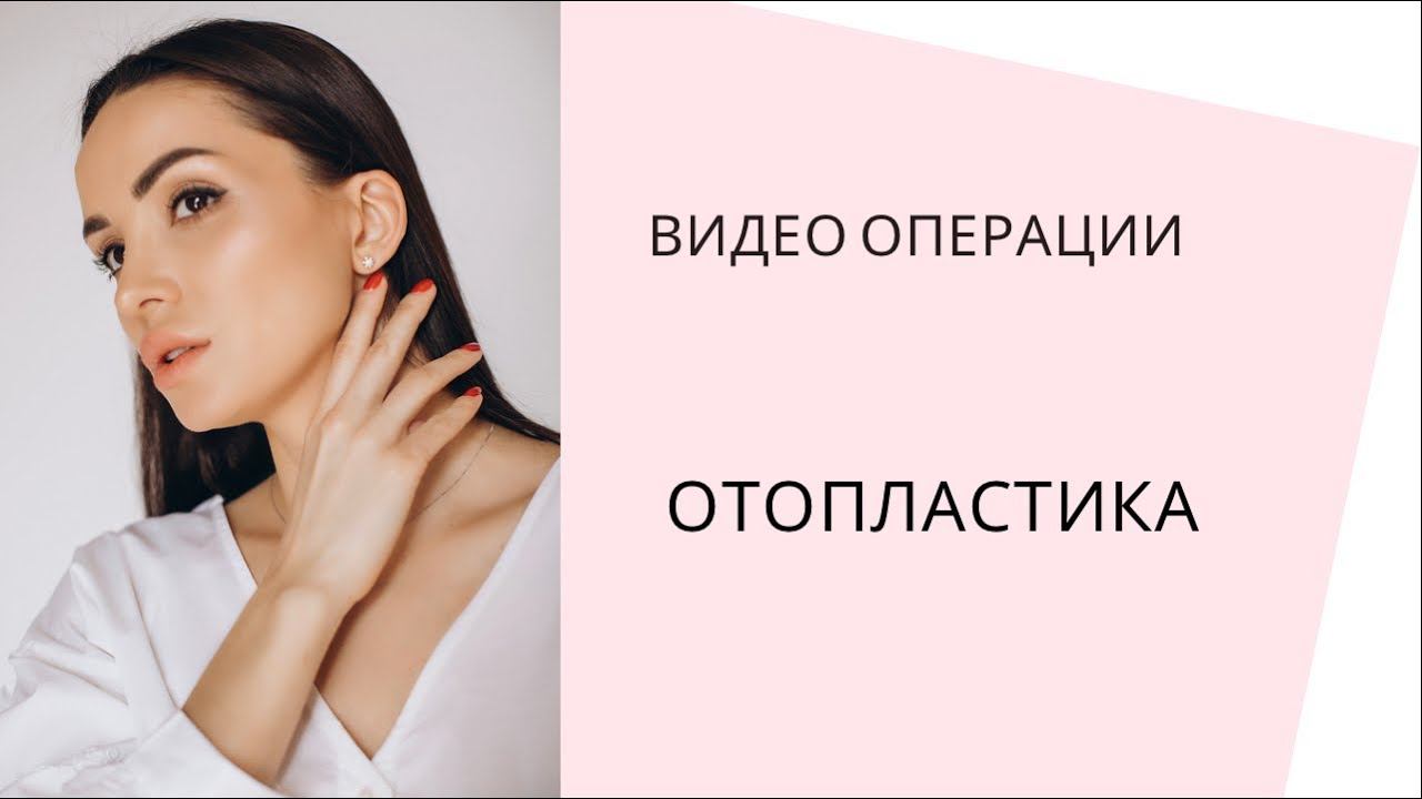 Отопластика