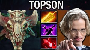 Viper Dota 2 Gameplay Old G.Topson with Radiance - Bloodstone