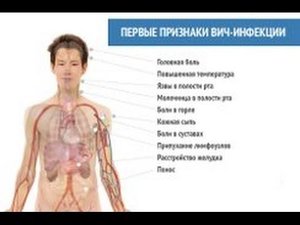 ВИЧ инфекция  ВИЧ симптомы у мужчин и женщин  Как передается ВИЧ  Признаки и про