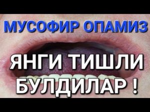 ПРОТЕЗ ТИШЛАР КУЙИШ ! МОСКВА + 79636579707 ВАТСАП ТЕЛЕГРАМ ИМО