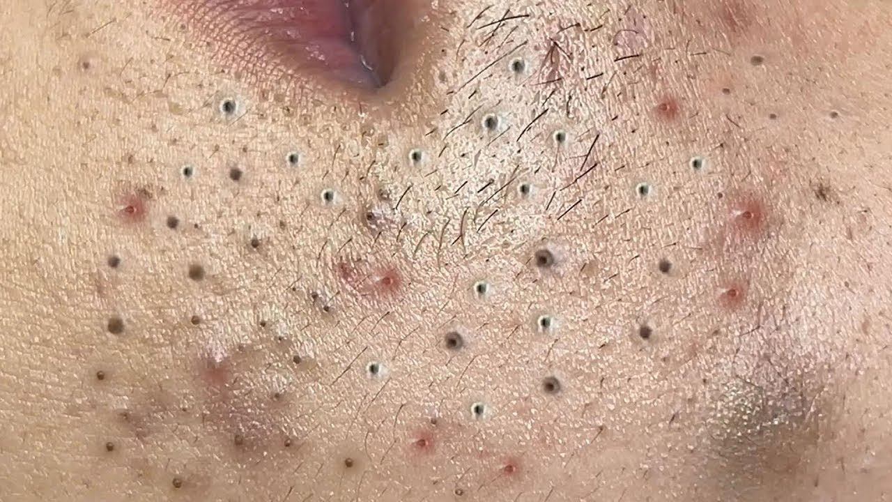 Satisfying and Relaxing with Alisa Beauty Spa Videos #28