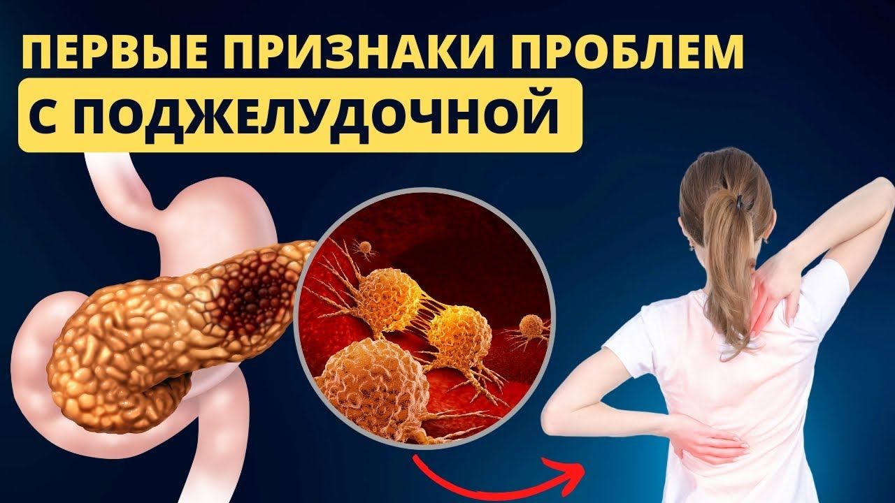 ПОДЖЕЛУДОЧНАЯ Секреты которые вы должны знать #поджелудочная