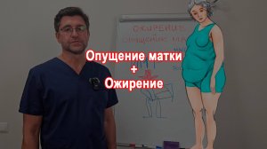 Опущение матки и ожирение