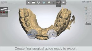 DS2013   Implant Planning and Guided Surgery