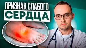 7 ПРИЗНАКОВ СЛАБОГО СЕРДЦА. Предотврати сердечную недостаточность, пока не поздно