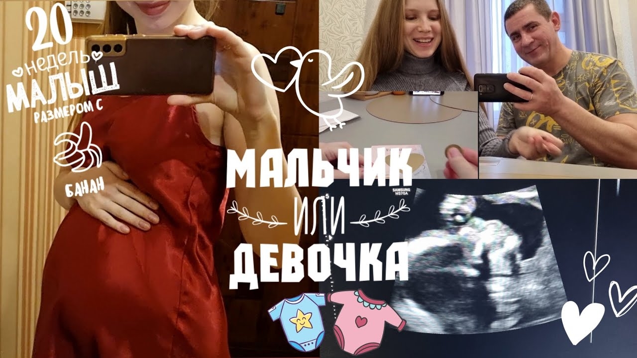 ВТОРОЙ СКРИНИНГ🥰УЗНАЁМ ПОЛ РЕБЁНКА🩷💙20 НЕДЕЛЬ БЕРЕМЕННОСТИ смотреть онлайн