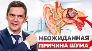 Надоел Шум и Звон в Ушах? Сделай Это, Чтобы От Него Избавиться!