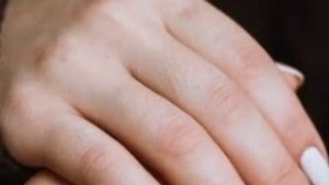 White & Glow Knuckle Whitening Serum Review in hindi| Whitening Serum For Dark Knuckles Elbow & Kne