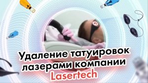 Процедуры Lasertech: Удаление татуировок лазерами компании Lasertech