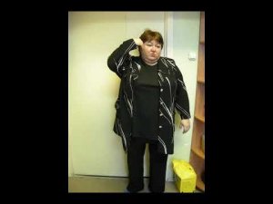 Ложный сустав н\3 правой плечевой кости. Больная А. 54 года.