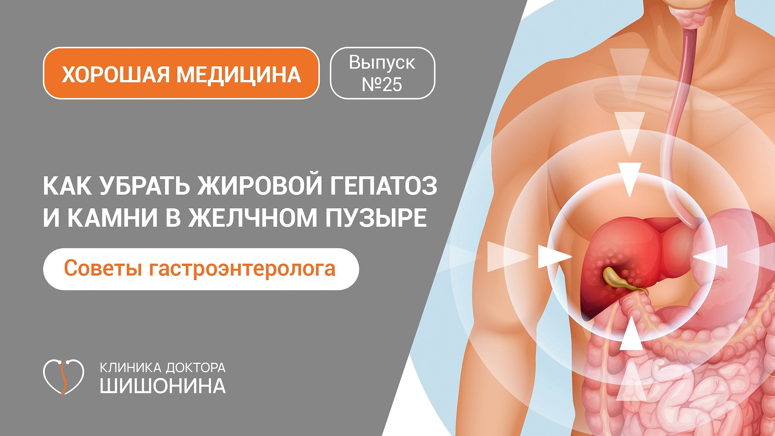 Как убрать жировой гепатоз и камни в желчном пузыре - рассказывает лучший гастроэнтеролог Москвы 🩺❤