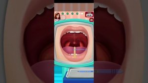 tonsillectomy (тонзиллэктомия).
