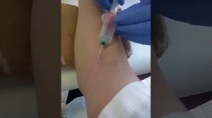 Кровь из вены