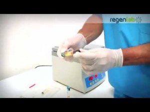 RegenLab PRP