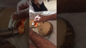 Интубация трахеи