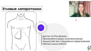 Топографическая анатомия | Виды лапаратомий. Ревизия брюшной полости. Оперативная хирургия