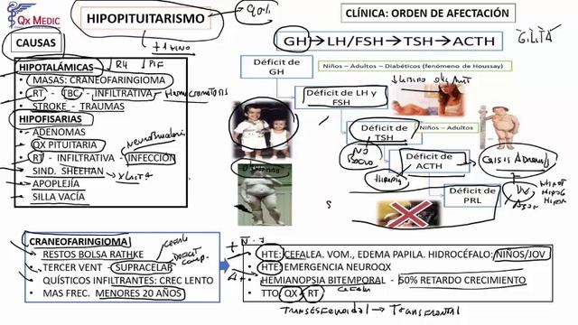 Endocrinología - 2 RM 2V ENDOCRINOLOGIA DIA 1 HIPOPITUITARISMO ADENOMA HIPOFISIARIO HIPERPROLACT смотреть онлайн